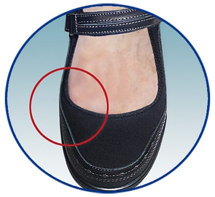 When to stretch shoes for bunions and when to see a professional