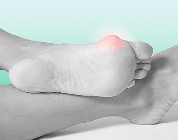 How to Prevent Bunions From Getting Worse | OrthoFeet – Orthofeet®