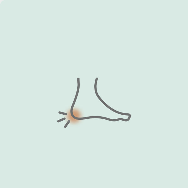 Plantar Fasciitis