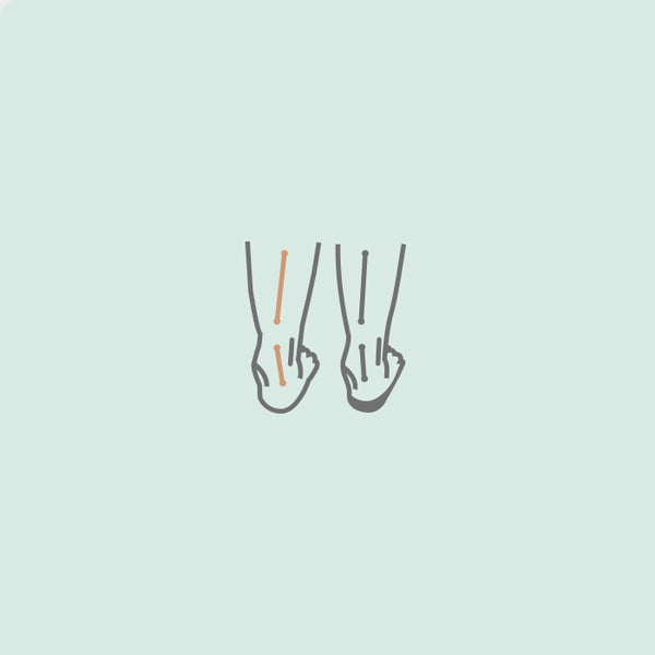 Overpronation